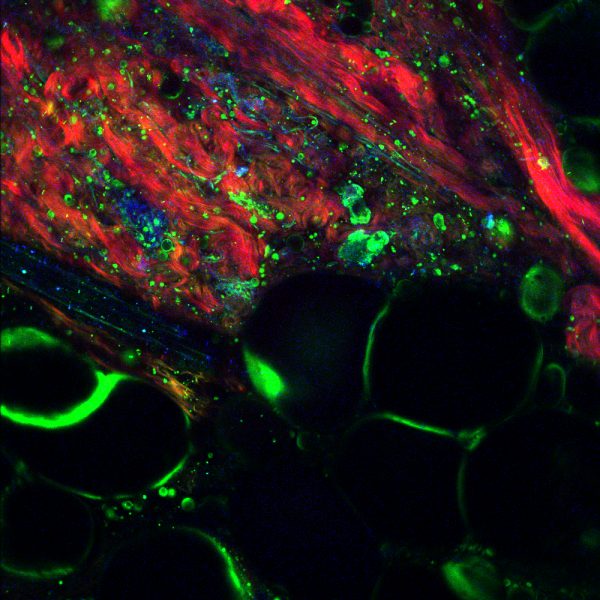 Brain tissue image using femtosecond laser